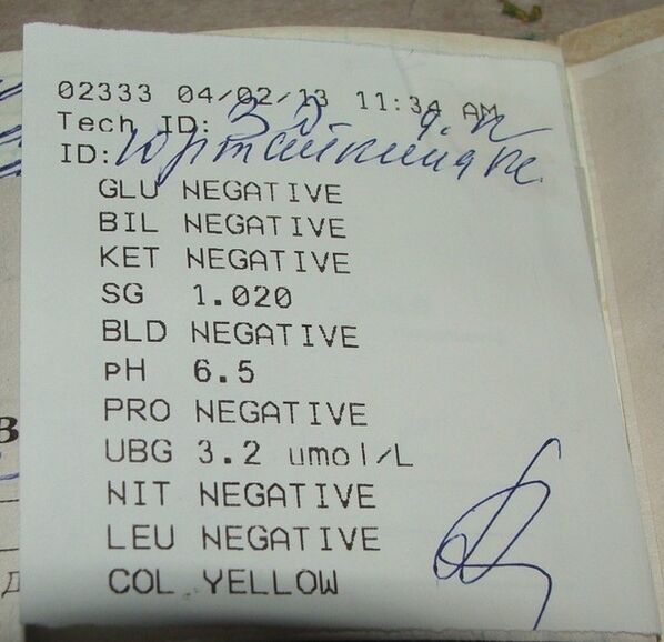 My urine analysis results before Femixal